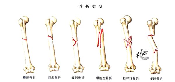 螞蟻莊園“寒潮橙色預警是什么等級